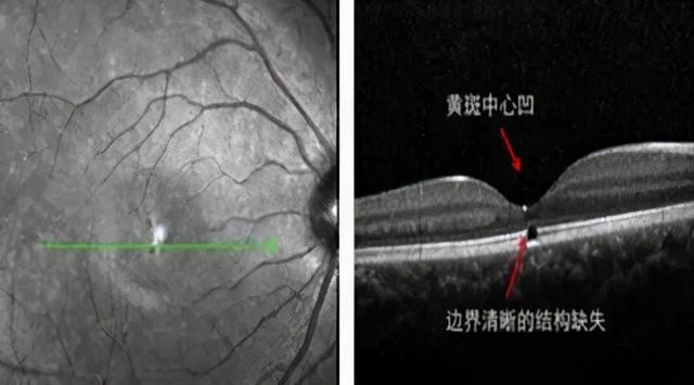 激光防護(激光個人防護措施) 第3張
